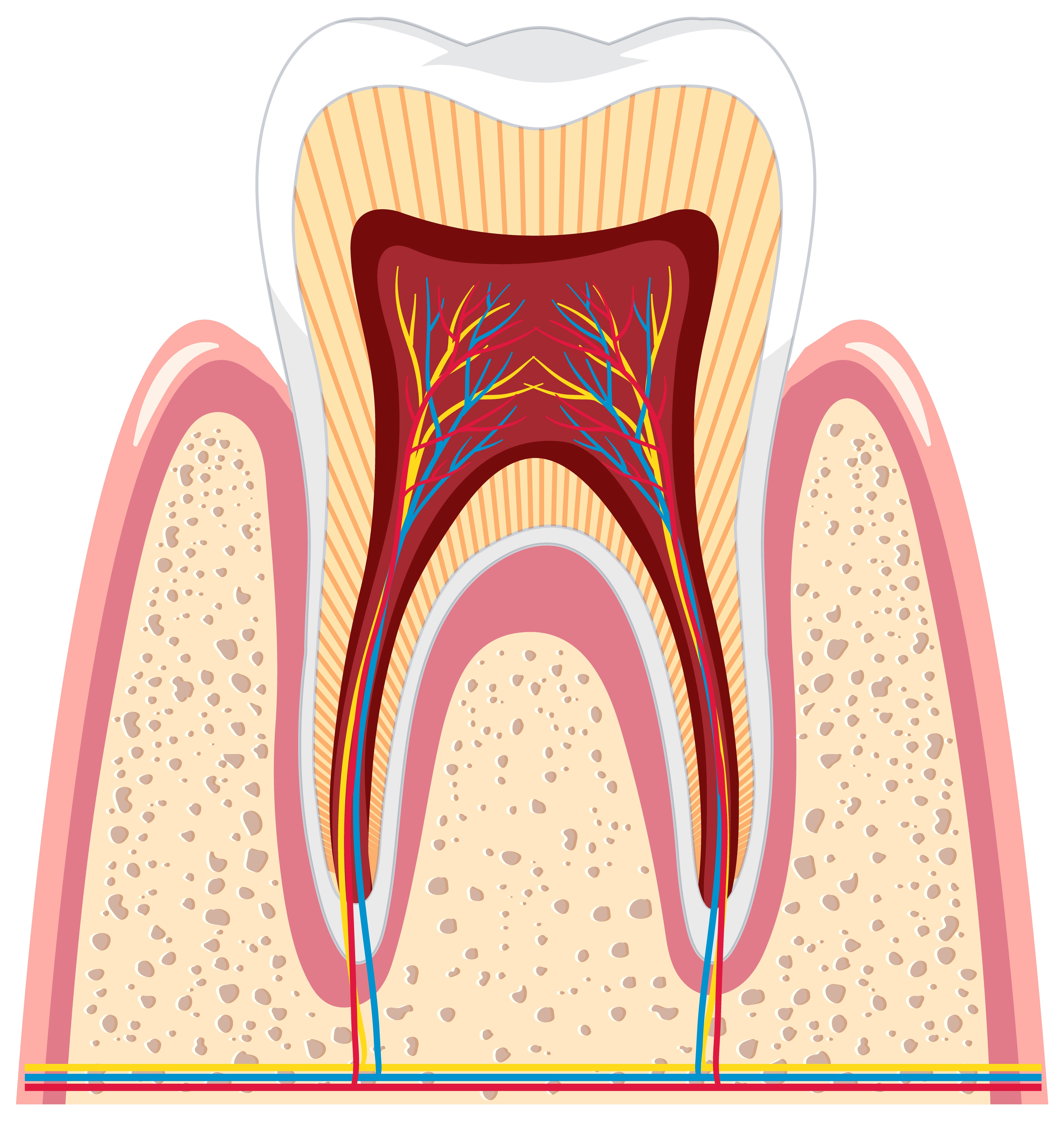 Root Canal Treatment (RCT)